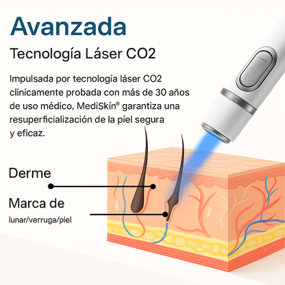 MediSkin Láser – Elimina manchas y verrugas | Resultados rápidos